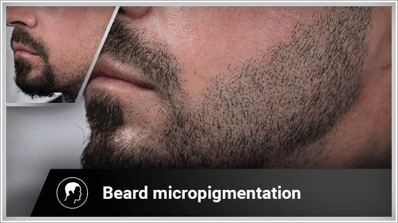 beard micropigmentation left side