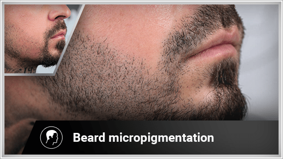 beard micropigmentation right side