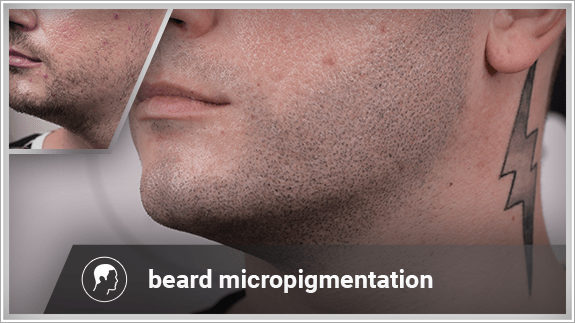 beard micropigmentation left side