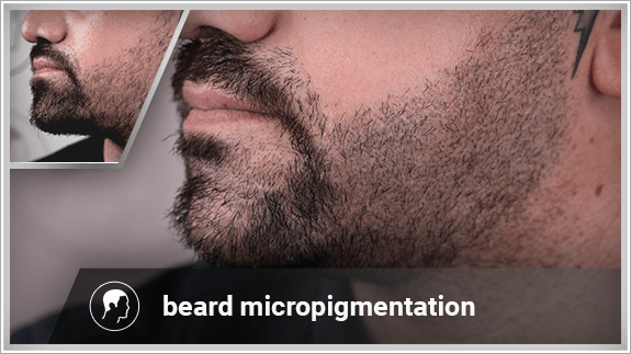 beard micropigmentation left side