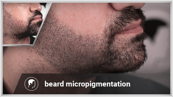 beard micropigmentation right side
