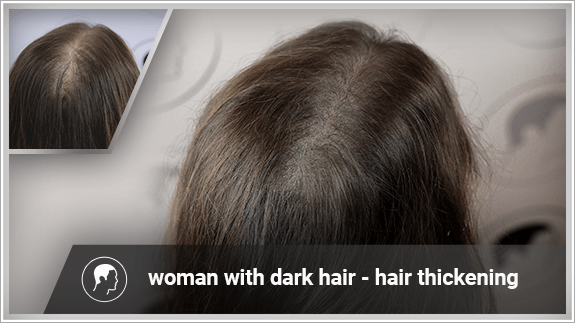 hair thickening - woman with dark hair