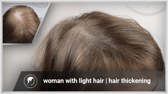 hair thickening - woman with light hair