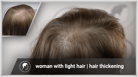 hair thickening - woman with light hair