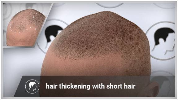 hair thickening with short hair