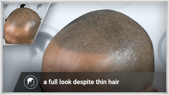 a full look despite thin hair