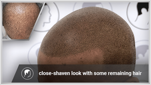 close-shaven look with some remaining hair