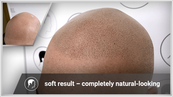 soft result – completely natural-looking