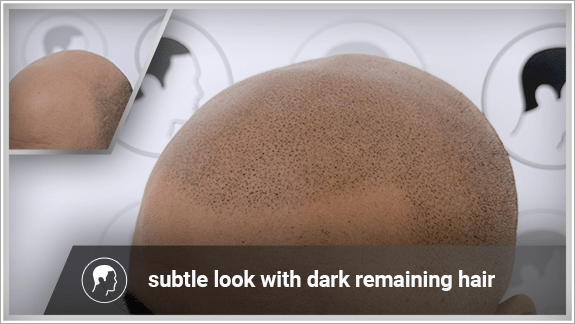 subtle look with dark remaining hair