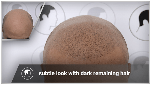 subtle look with dark remaining hair