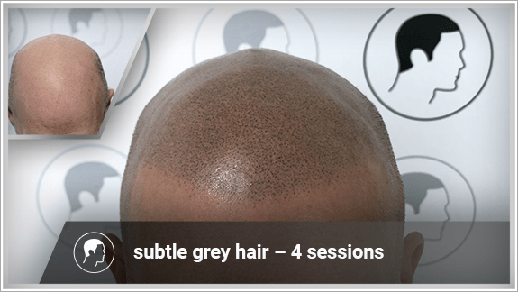 subtle grey hair – 4 sessions