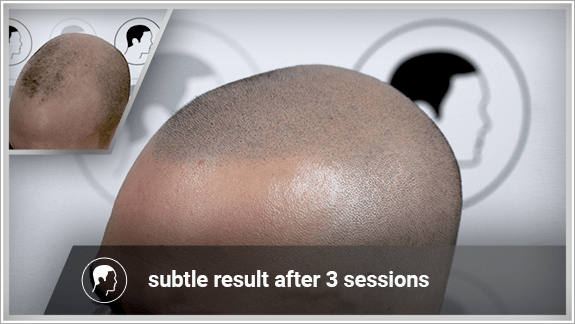 subtle result after 3 sessions