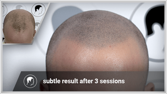 subtle result after 3 sessions