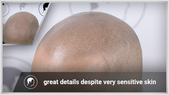 great details despite very sensitive skin