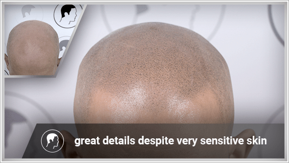 great details despite very sensitive skin
