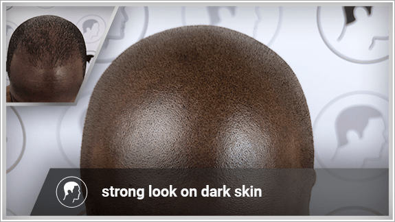 strong look on dark skin