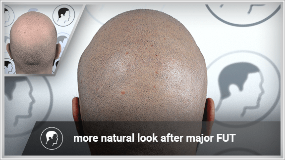 more natural look after major FUT