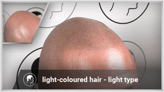 light-coloured hair - light type
