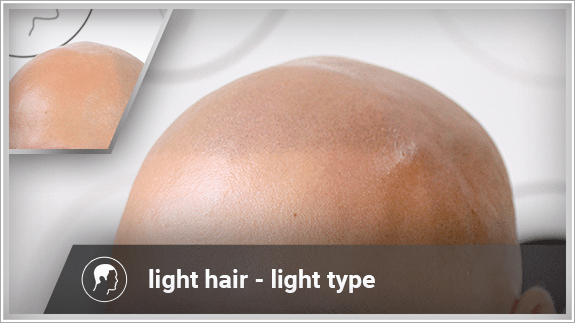 light hair - light type