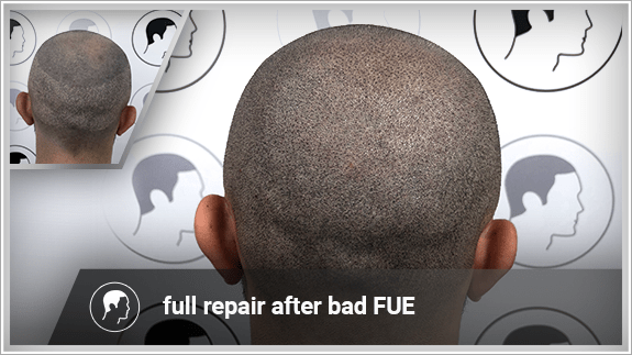 full repair after bad FUE