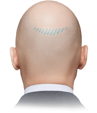 Back of head
