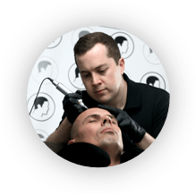 Scalp micropigmentation on client