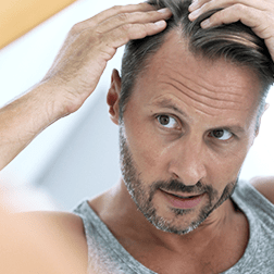First signs of hair loss usually start at the hairline.