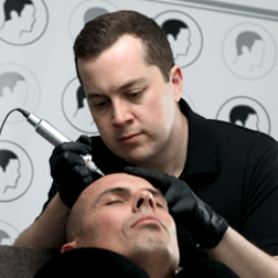 Scalp micropigmentation in action.