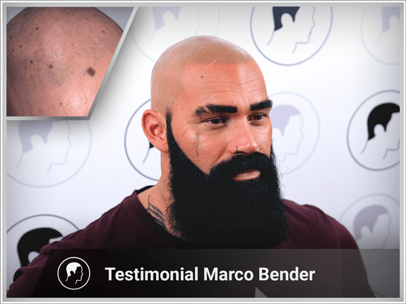 Marco Bender's interview