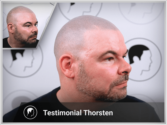 Thorsten's interview